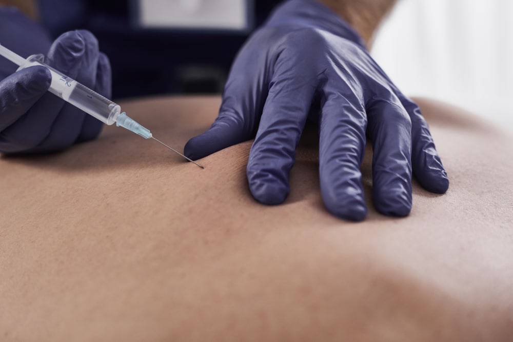 CONDITIONS TREATED WITH EPIDURAL INJECTIONS