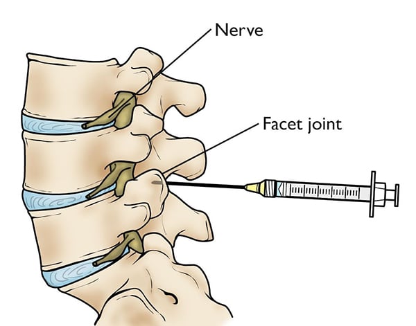 img Pain Clinic of North Texas